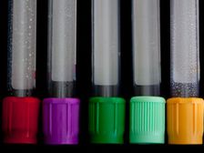 మీ బ్లడ్ గ్రూప్ ఆహారం ఏమిటి?