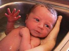 నెలలు నిండకుండా పుట్టే బేబీలకు భవిష్యత్తులో సమస్యలే?