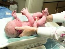 బరువు తక్కువగా పుట్టే పిల్లలకు కారణాలు... తీసుకోవల్సిన జాగ్రత్తలు