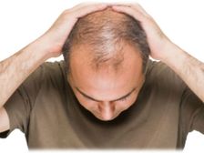 జుట్టు ఊడిపోవడానికి గల 10 ప్రధాన కారణాలు..!