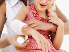 కాలిన గాయలకు వెంటనే ఇంట్లో చేసే చికిత్సా పద్దతు