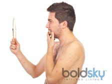 వేసవిలో చికెన్ పాక్స్(అమ్మవారు)తో తస్మాత్ జాగ్రత్త