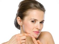 మానసిక ఒత్తిళ్ళు తగ్గించుకొంటే మొటిమలు మాయం...