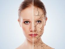 చలికాలంలో డ్రై స్కిన్ నివారించేందుకు ఉత్తమ మార్గాలు