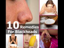  బ్లాక్ హెడ్స్ ను నివారించే వండర్ ఫుల్ హోం రెమెడీస్