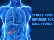 గాల్ స్టోన్ (పిత్తాశయంలో రాళ్ళు)కరిగించే ఉత్తమ హోం రెమెడీలు