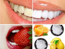 గారపళ్లతో నలుగురిలో నవ్వడానికి ఇబ్బంది పడుతున్నారా ?