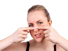 ముక్కు మీద మొటిమలు తొలగించడానికి 5 సాధారణ మార్గాలు