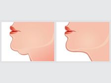 జ్యోతిష్యంతో పని లేదు..!! గడ్డం ఆకారం చూస్తే చాలు..!!