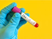 జికా వైరస్ గురించి ఖచ్చితంగా తెలుసుకోవాల్సిన విషయాలు