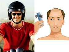 హెల్మెట్ పెట్టుకోవడం వల్ల బట్టతల వస్తుందా ?