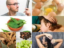 హెయిర్ ఫాల్, బట్టతలకు గుడ్ బై చెప్పే 10 ఎఫెక్టివ్ హోం రెమెడీస్...