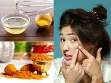 డూ ఇట్ యువర్ సెల్ఫ్: మొటిమలు, మచ్చలను నివారించే ఫవర్ ఫుల్ ఫేస్ ప్యాక్ 