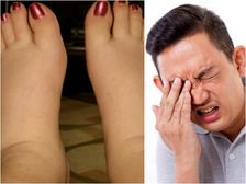 శరీర భాగాల్లో ఏర్పడే వాపులు ఎలాంటి వ్యాధులను సూచిస్తాయి ?