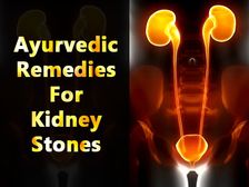 కిడ్నీ స్టోన్స్ నివారించే ఆయుర్వేదిక్ రెమెడీస్ 