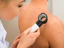 శరీర భాగాల్లో వచ్చే మొటిమలు.. జబ్బులను సూచిస్తాయా ? 