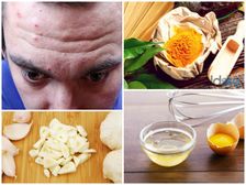 అబ్బాయిల్లో మొటిమలను తేలికగా నివారించే ఎఫెక్టివ్ హోం రెమిడీస్..!!