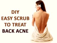వీపు మీద మొటిమలను నివారించే లెమన్ షుగర్ బాడీ స్ర్కబ్ 