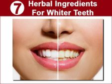 దంతాలను తెల్లగా మిళమిళ మెరిపించే 7 హెర్బల్ రెమెడీస్ 