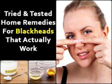 బ్లాక్ హెడ్స్ ను ఎఫెక్టివ్ గా తొలగించే హోం రెమెడీస్...!