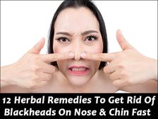 ముక్కు, గెడ్డంపై  మీద బ్లాక్ హెడ్స్ ను తొలగించే 12 హెర్బల్ రెమెడీస్ ..!