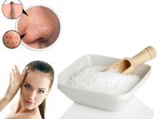 నొప్పి లేకుండా బ్లాక్ హెడ్స్ తొలగించే సింపుల్ హోం ట్రీట్మెంట్..