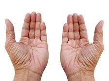 మీ లైఫ్ ఎలా ఉంటుందో మీ అరచేతిలో ఉండే  పుట్టుమచ్చలు తెలుపుతాయి