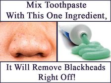 టూత్ పేస్ట్ ఒకే ఒక పదార్థం కలిపి అప్లై చేస్తే బ్లాక్ హెడ్స్ మాయం