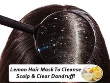 చుండ్రుని శాశ్వతంగా తొలగించే.. సింపుల్ అండ్ పర్ఫెక్ట్ రెమెడీ..!!