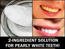 పాచి, గార పట్టి.. అసహ్యంగా మారిన పళ్లను తెల్లగా మార్చే ఎఫెక్టివ్ రెమెడీ..!!