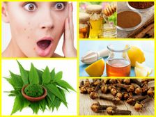 మొటిమలను పర్మనెంట్ గా నివారించే బేసిక్ అండ్ ఎఫెక్టివ్ ఆయుర్వేద చిట్కాలు..!!