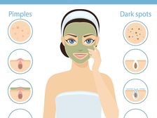 సింపుల్ టిప్స్ : చర్మంలో డార్క్ స్పాట్స్ నివారించే ఎఫెక్టివ్ హోం రెమెడీస్..!