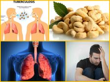 ప్రాణాంతక టీ.బి(ట్యుబర్కులోసిస్),న్యుమోనియాను నివారించే ఒకే ఒక్క డ్రై నట్: జీడిపప్పు