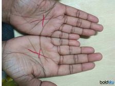 ప్రపంచంలో కొంతమందికి మాత్రమే అరచేతిలో ఉండే ఈ ‘‘X