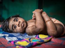 గుండెల్ని పిండేసే ఓ వింత కథ : ఆమె కుమారుడు తోడేలు జన్యువుతో పుట్టాడు..? ఎలా? 