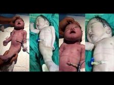 ఇలాంటి వింత శిశువులు మీకు పుట్టే అవకాశం ఉంది! ఎందుకో తెలుసుకోండి