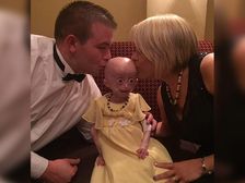 అరుదైన వ్యాధితో ఎనిమిదేళ్ల వ‌య‌సులో మృత్యువుతో పోరాటం! చివ‌రికి ఏమైంది! 