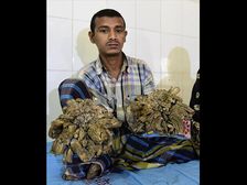 చెట్టంత మనిషి.. చెట్టులా మారిపోతున్నాడు