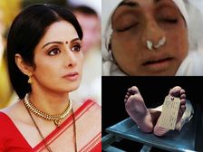 శ్రీదేవి బాడీని ఎంబామింగ్ చేయబడింది: ఎంబామింగ్ అంటే ఎమిటి? ఎలా చేస్తారు? తెలుసా!