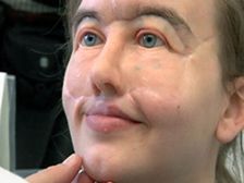 ఆమె ముఖంపై తుపాకి గాయం మిగిల్చింది..... ఆమె రూపం ఇప్పుడు ఇలా ఉంది...!