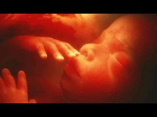 తల్లి సర్జరీ కోసమనీ పొట్టలోని శిశువును బయటకు తీసి, తిరిగి పొట్టలో అమర్చిన ఆశ్చర్యకర సంఘటన