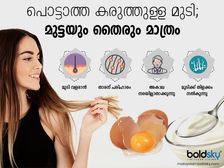 మీ జుట్టు ఆరోగ్యంగా మరియు స్ట్రాంగ్ ఉంచేవి పెరుగు మరియు గుడ్డు మాత్రమే!!..ఎందుకంటే?