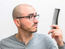  బట్టతల: ఈ దురఅలవాట్లను ఇప్పుడే మానండి, నియంత్రణ కోసం ఈ పద్ధతిని ఉపయోగించండి