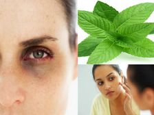 నల్లటి వలయాన్ని పోగొట్టాలంటే ఒక్క పిప్పరమెంటు ఆకులు చాలు!