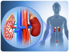 ప్రాణాంతక మూత్రపిండ వ్యాధి గురించి ఎప్పుడైనా విన్నారా?