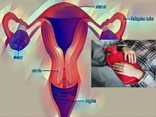 మీరు తరచుగా పెల్విక్ (గర్భాశయ)నొప్పిని అనుభవిస్తున్నారా?గర్భాశయ క్యాన్సర్‌కు సంకేతం కావచ్చు..