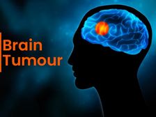 World Brain Tumour Day 2020:మెదడు కణితి రకాలు, కారణాలు, లక్షణాలు, ప్రమాదాలు మరియు చికిత్స