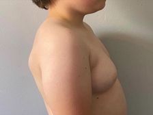 ఆ బాలుడిలో బాలికల లక్షణాలు... కొడుకు కోసం బ్రా కొనుగోలు చేసిన అమ్మ...