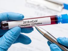 కరోనా పాజిటివ్ ఏ లక్షణాలు లేకుండా ఉందా? అయితే దీన్ని అనుసరించండి ...