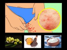 తొడ లోపలి భాగం చాలా దురదగా ఉందా? దాన్ని నివారించడానికి ఇక్కడ కొన్ని సాధారణ మార్గాలు ఉన్నాయి!